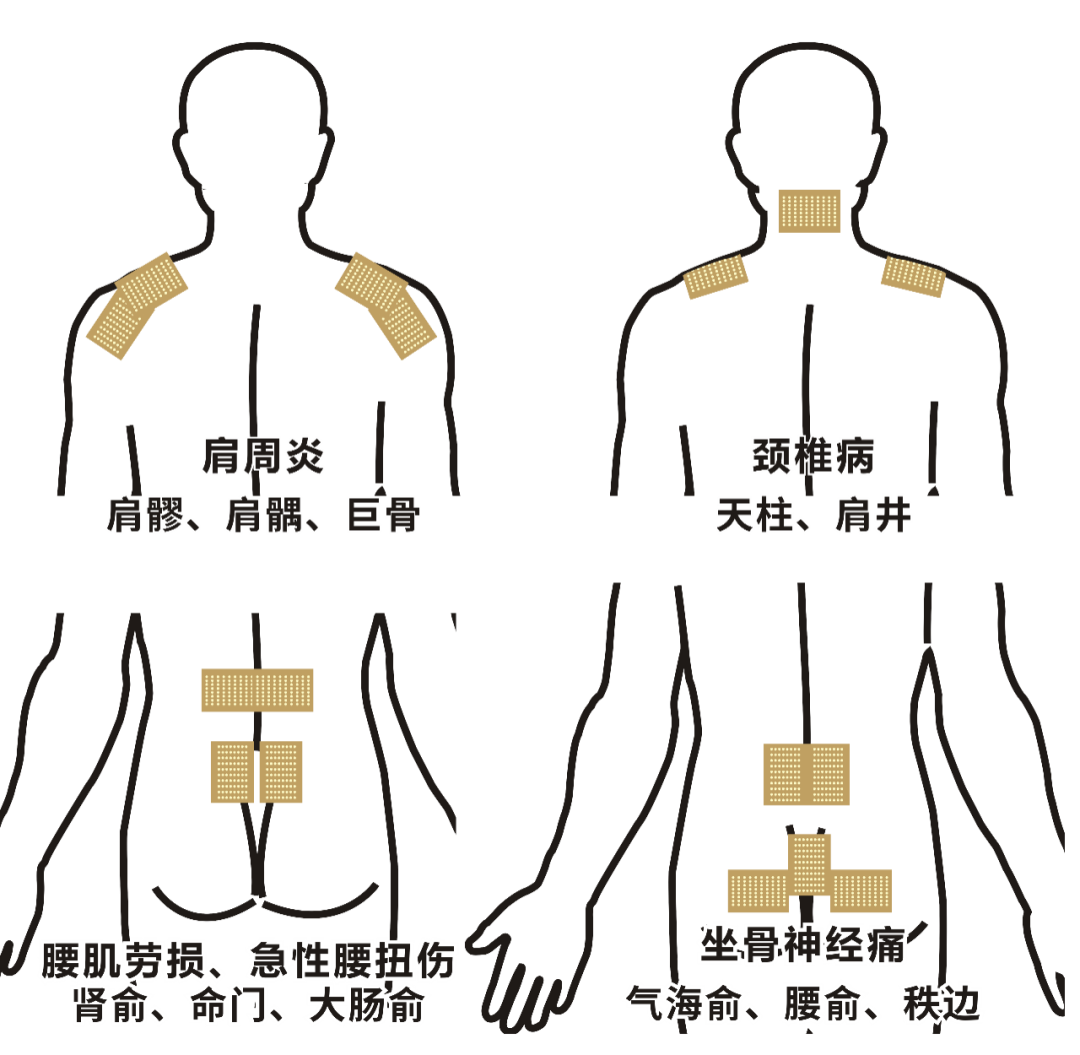 穴位1.png